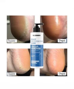 Alternative view of Roughened Skin & Calluses Remover Gel Mr.SCRUBBER
